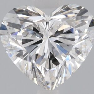 1.84 CT Heart