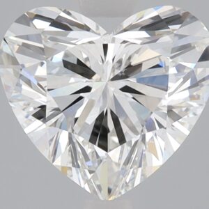 2.38 CT Heart