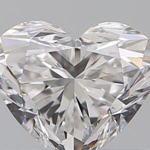0.52 CT HEART