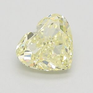 1.01 CT HEART