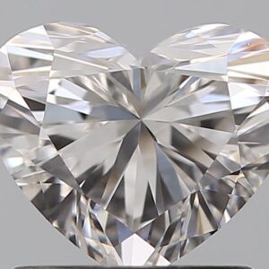 1.01 CT HEART
