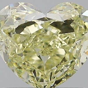 1.23 CT HEART