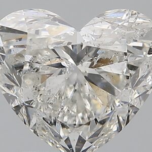 1.5 CT HEART