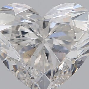 1.5 CT HEART