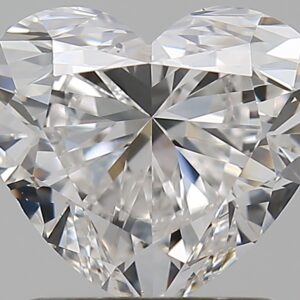 1.5 CT HEART