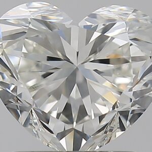 1.5 CT HEART