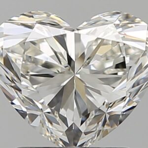 1.51 CT HEART