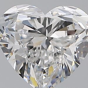 1.51 CT HEART