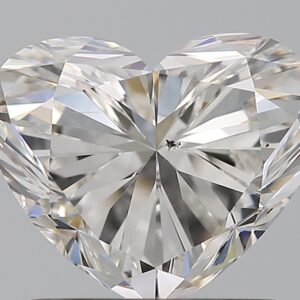 1.5 CT HEART