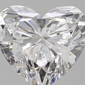 1.5 CT HEART