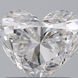 1.5 CT HEART