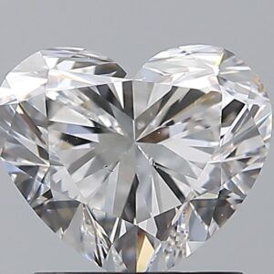 1.5 CT HEART