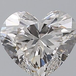 1.5 CT HEART