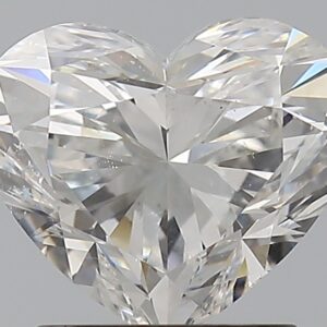 1.5 CT HEART