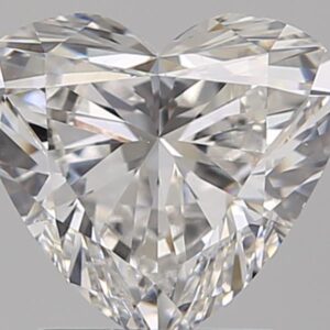 1.51 CT HEART