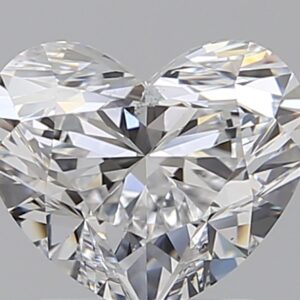 1.51 CT HEART