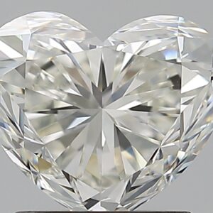 1.51 CT HEART