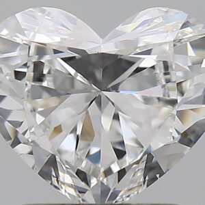 1.51 CT HEART