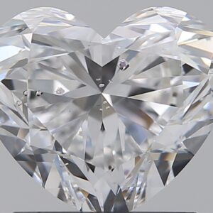 1.51 CT HEART
