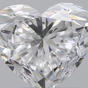 1.51 CT HEART