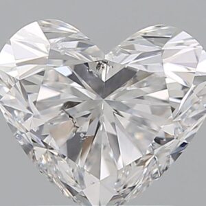1.51 CT HEART