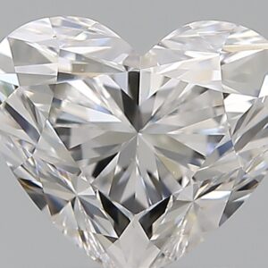 1.51 CT HEART