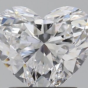 1.51 CT HEART