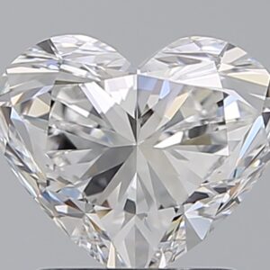 1.51 CT HEART