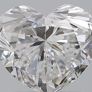 1.51 CT HEART