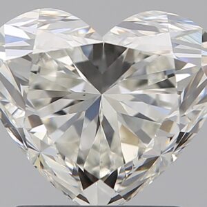 1.52 CT HEART