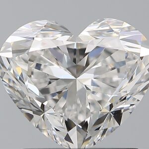 1.51 CT HEART