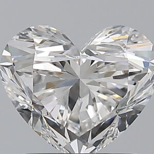 1.51 CT HEART