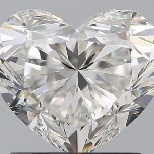 1.52 CT HEART