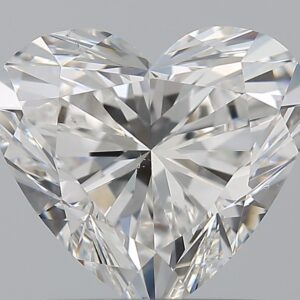 1.51 CT HEART