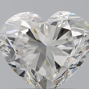 1.51 CT HEART