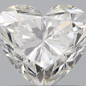 1.51 CT HEART
