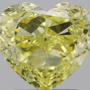 1.81 CT HEART