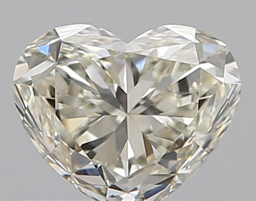 0.51 CT HEART