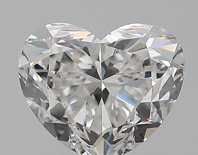 1.01 CT HEART