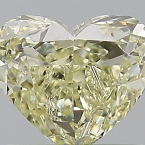 1.01 CT HEART