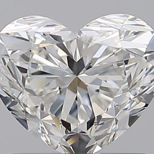 1.01 CT HEART