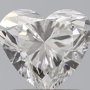 1.5 CT HEART