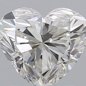 1.5 CT HEART