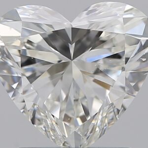 1.51 CT HEART
