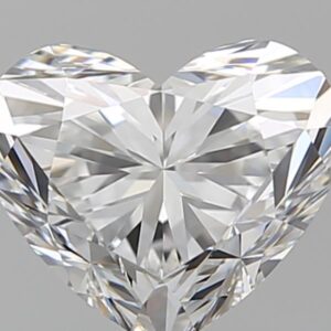 1.51 CT HEART