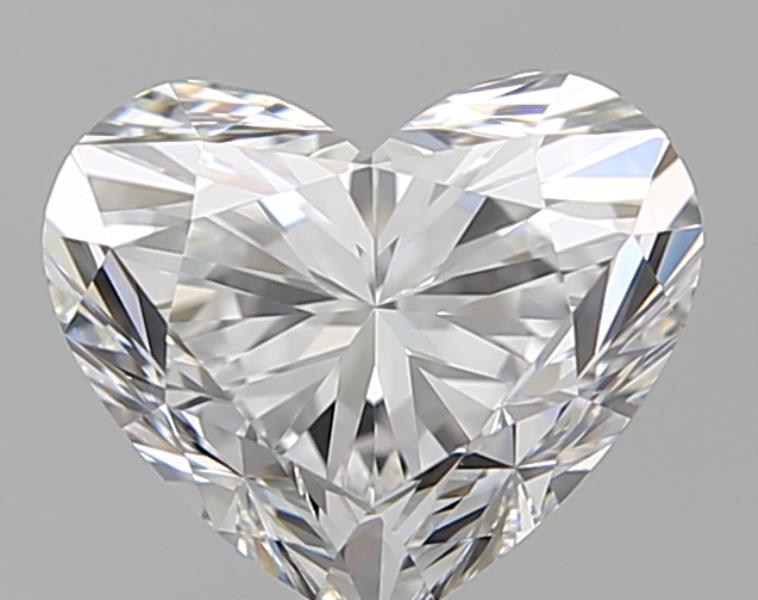 1.51 CT HEART