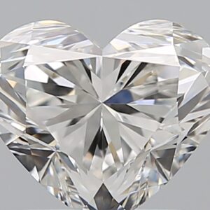1.51 CT HEART