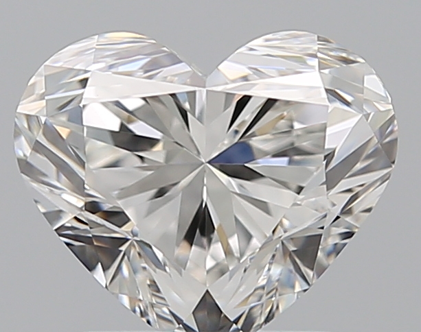 1.51 CT HEART