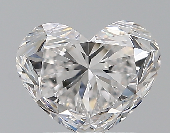 1.51 CT HEART
